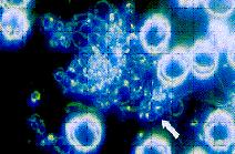 Mychits--spherical, primary bacterial cells